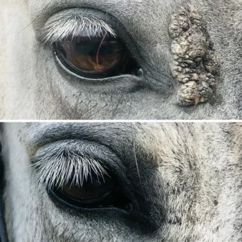 Fashion Cura Naturale Huile Excroissance Cutanée